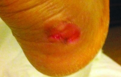 CBA球員抱怨李寧球鞋質量太差 后腳跟險被磨爛